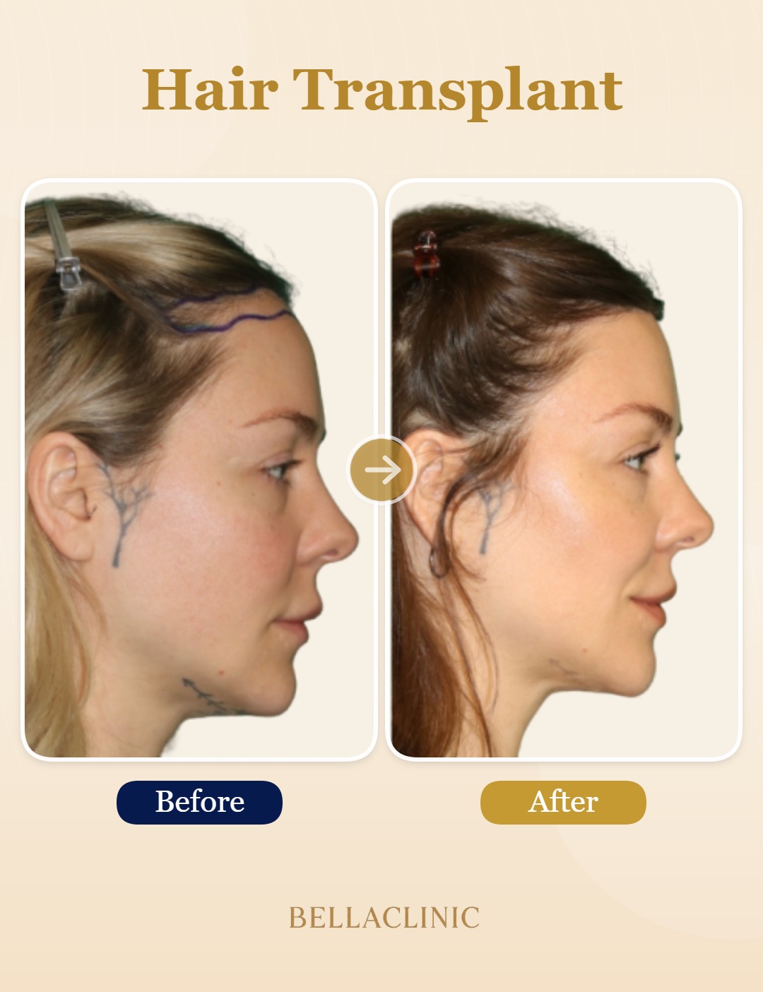 before-after-20260804-224244-6K4s21.jpg