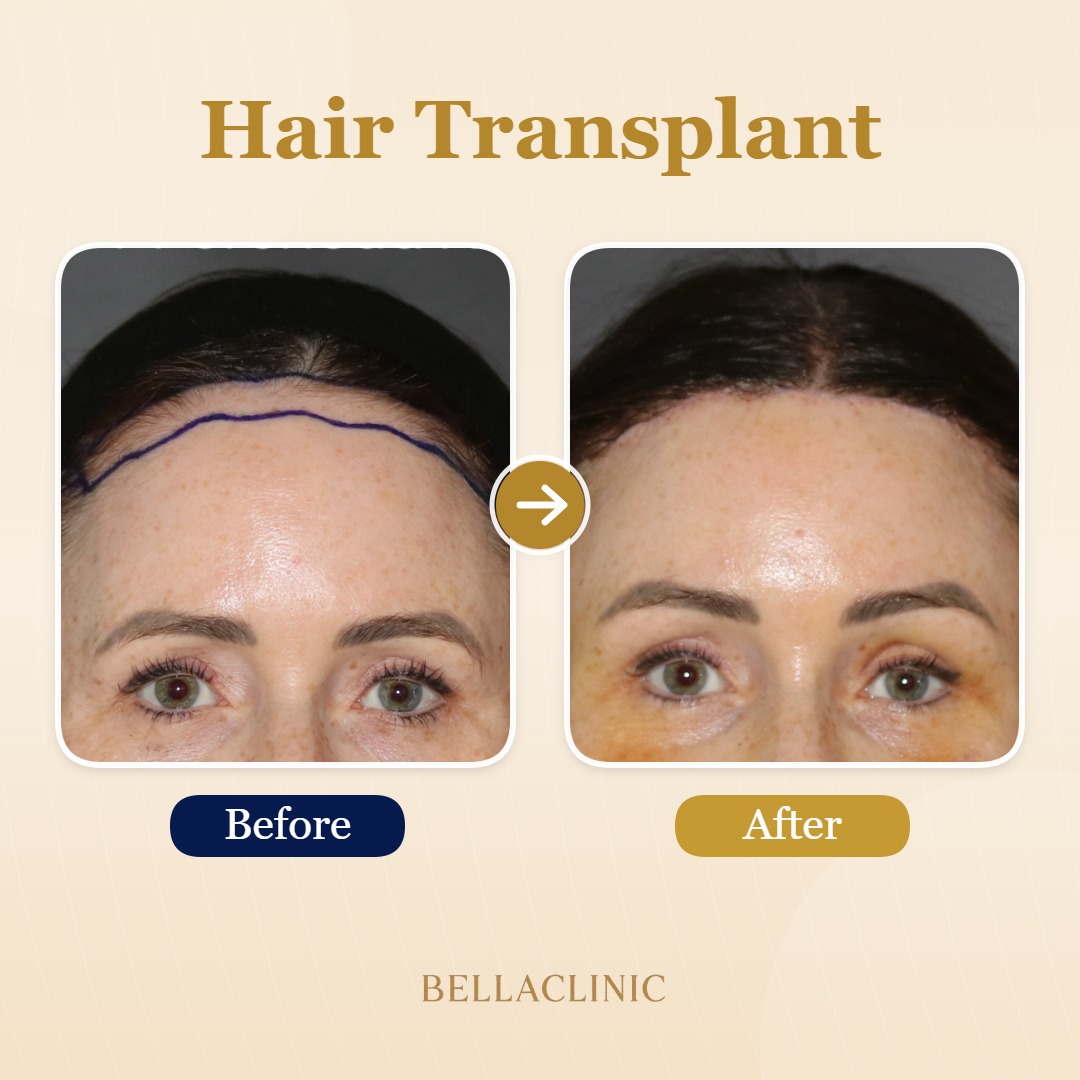 before-after-20260804-224347-eTGYxU.jpg