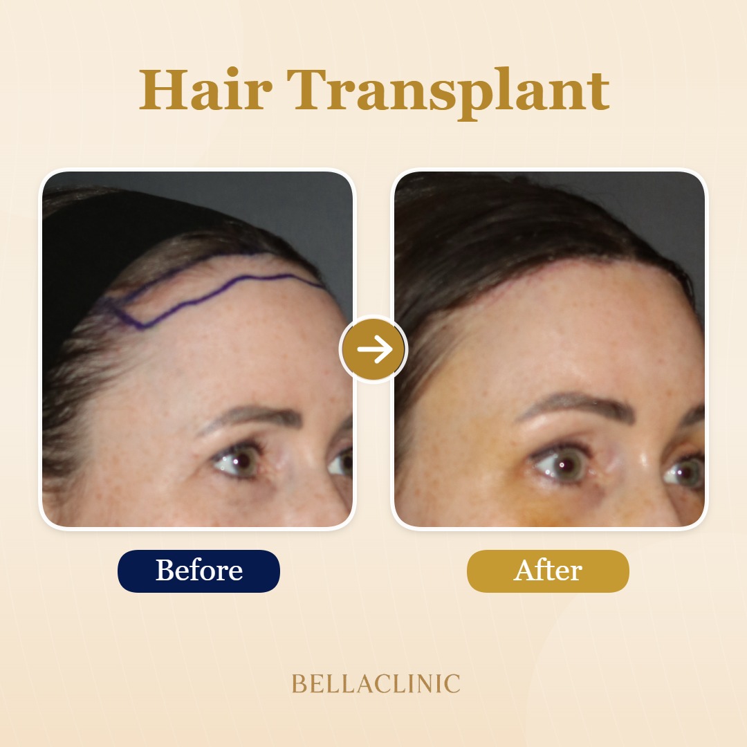 before-after-20260804-224453-ZhcumE.jpg
