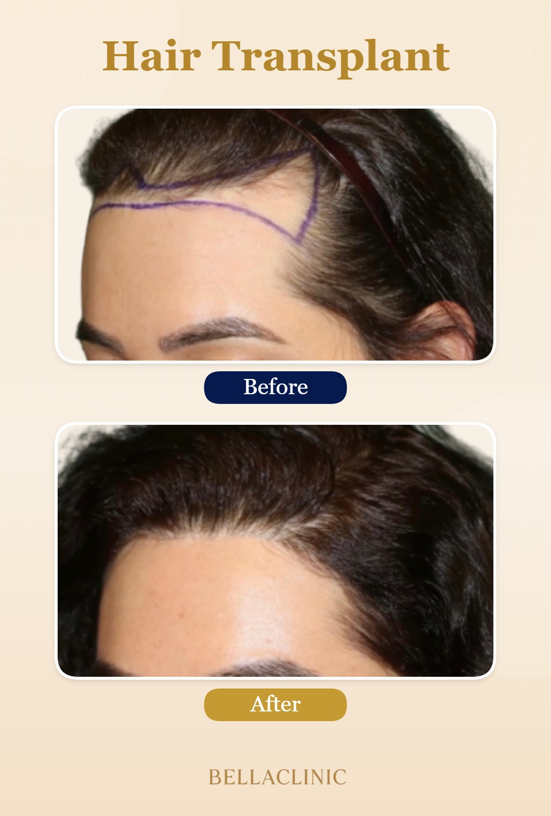 before-after-20260804-224556-aYXOkd.jpg