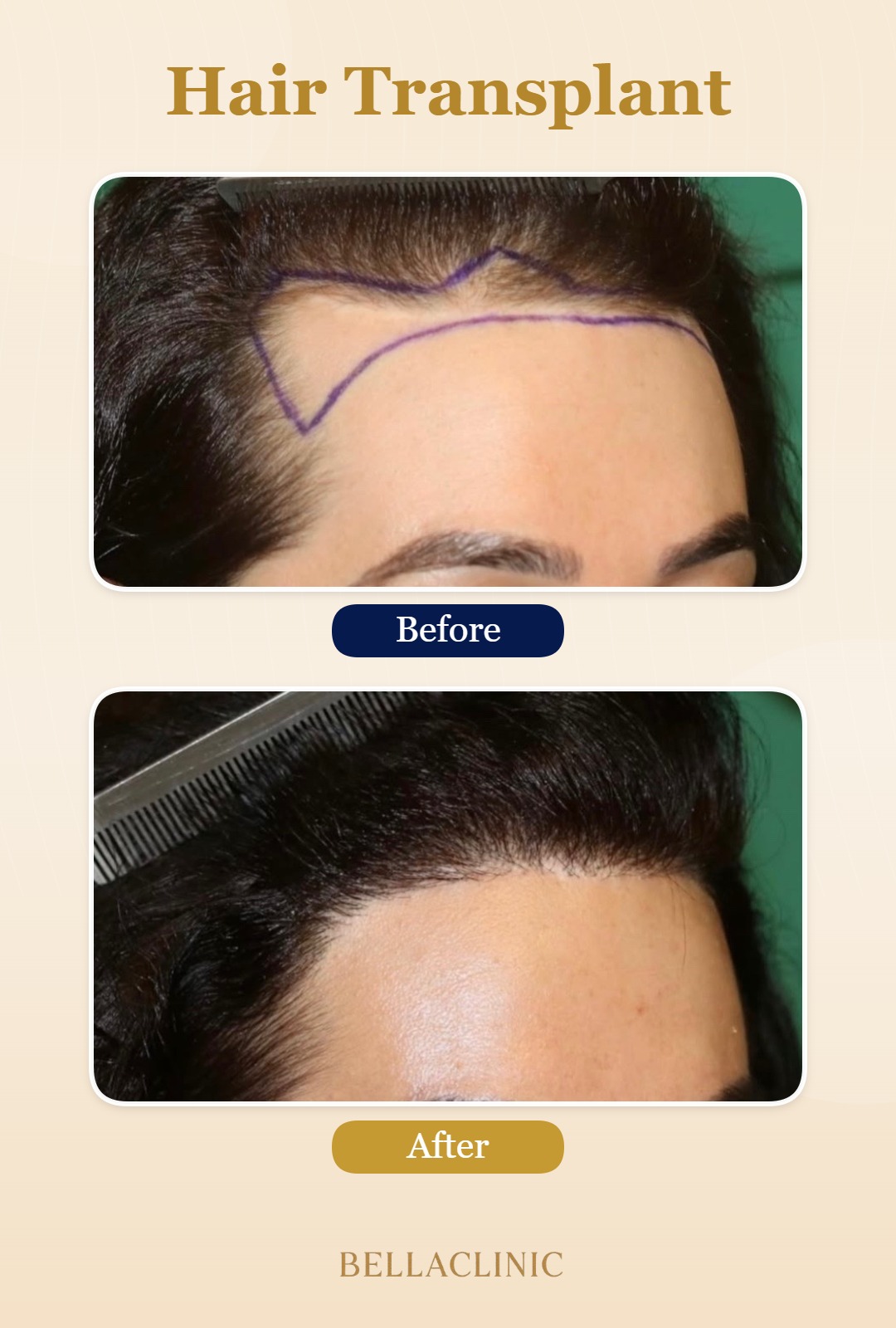 before-after-20260804-224710-j0IhK1.jpg