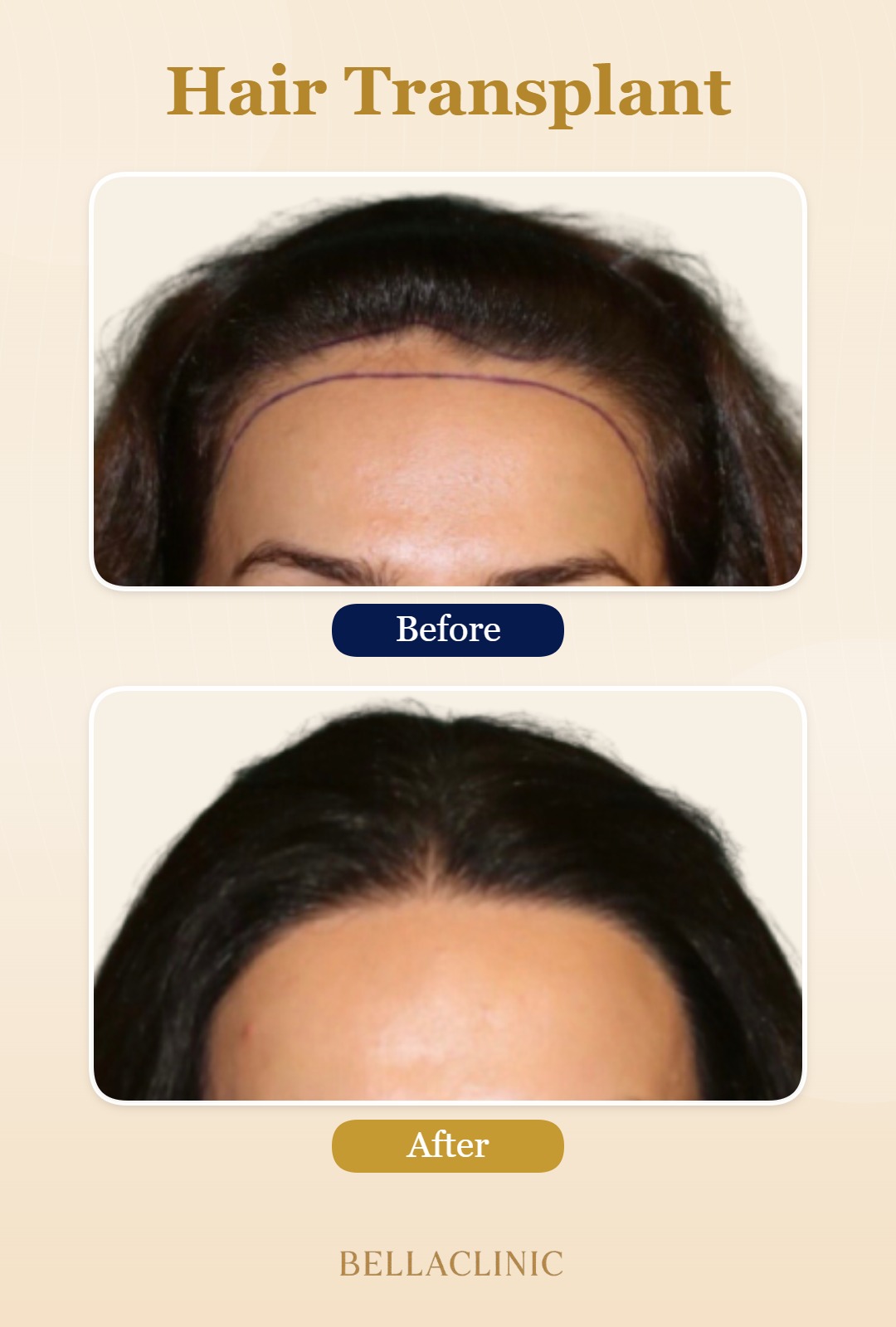 before-after-20260804-224816-ZW1wun.jpg