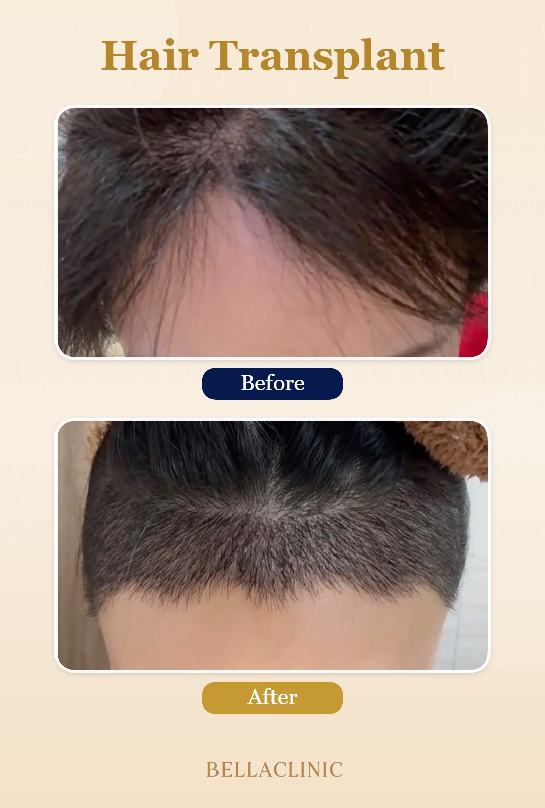 before-after-20260804-224921-HNyUku.jpg