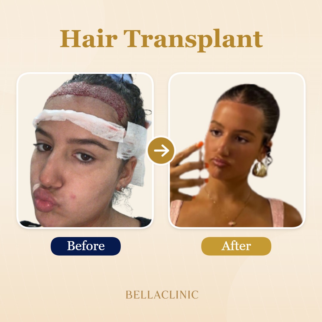 before-after-20260804-225342-hyRIcG.jpg