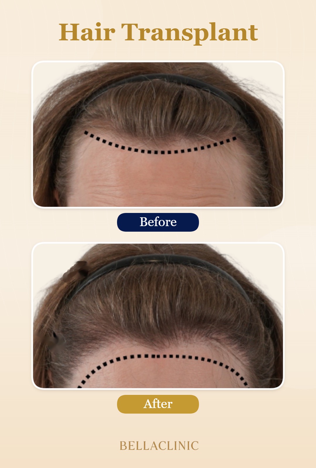 before-after-20260804-225956-1paQld.jpg