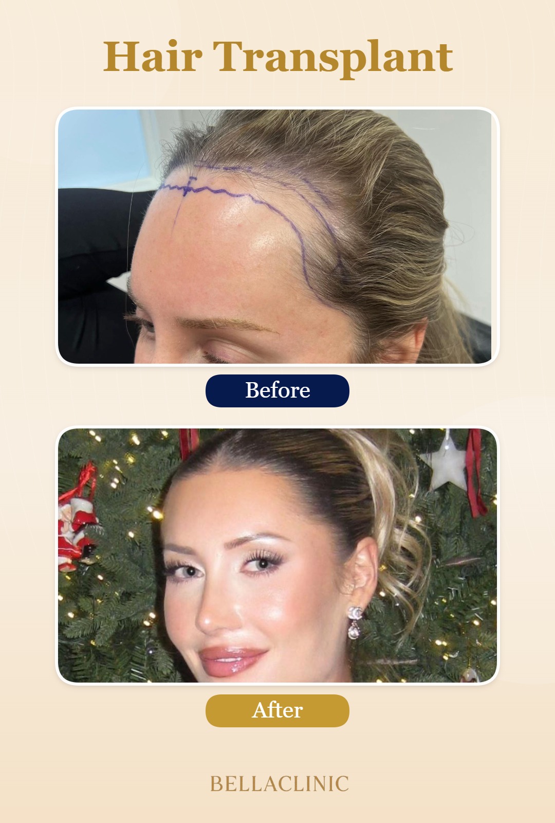 before-after-20260804-230457-Qk3l36.jpg
