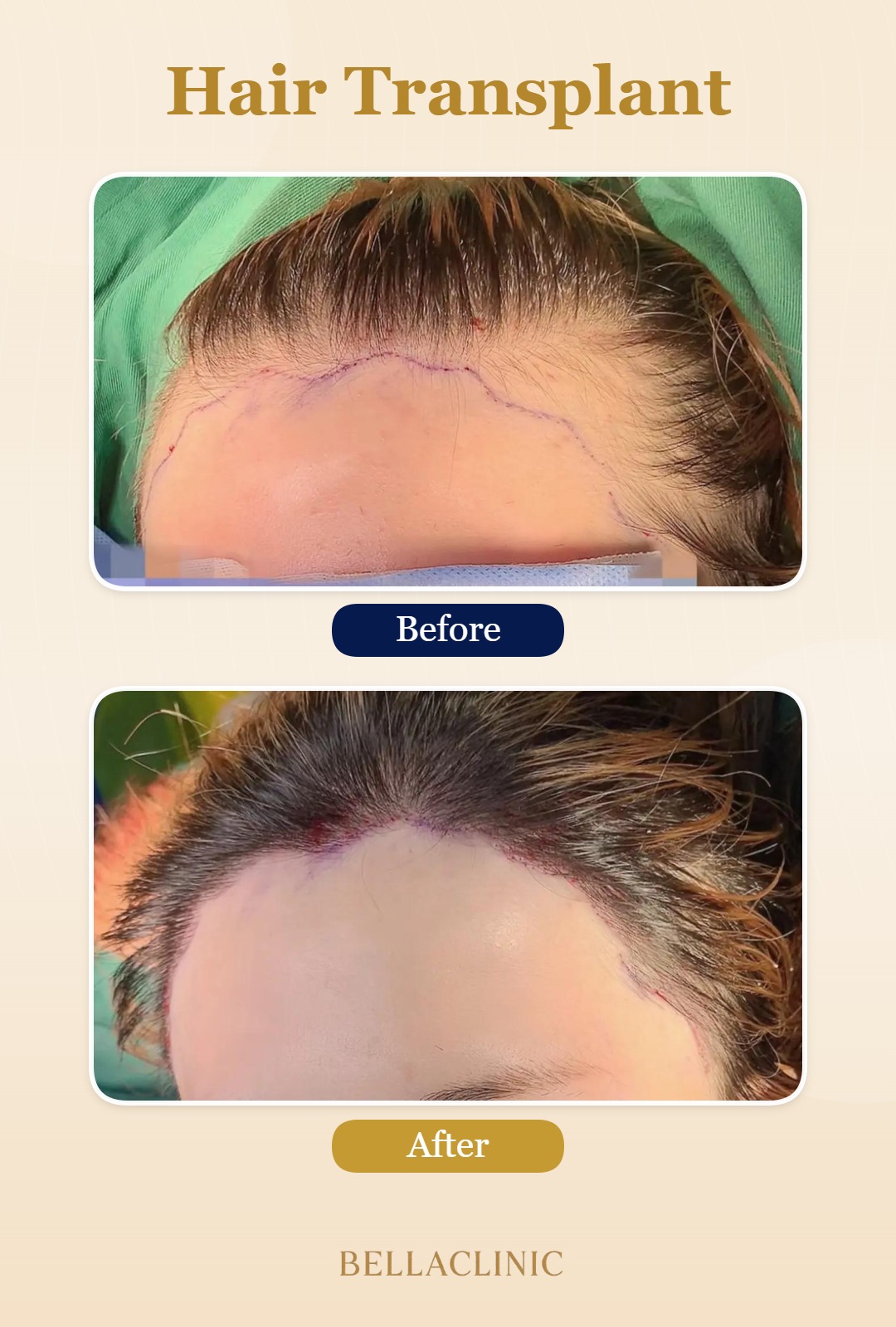 before-after-20260804-230552-45Q2qm.jpg