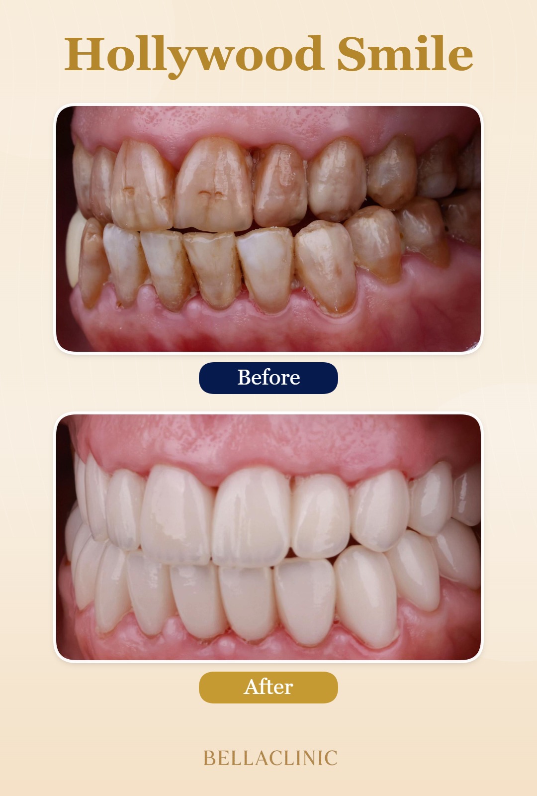before-after-20260722-113255-9WNKLT.jpg