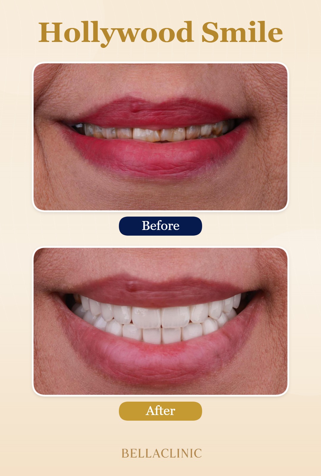 before-after-20260722-113348-AzlB2A.jpg
