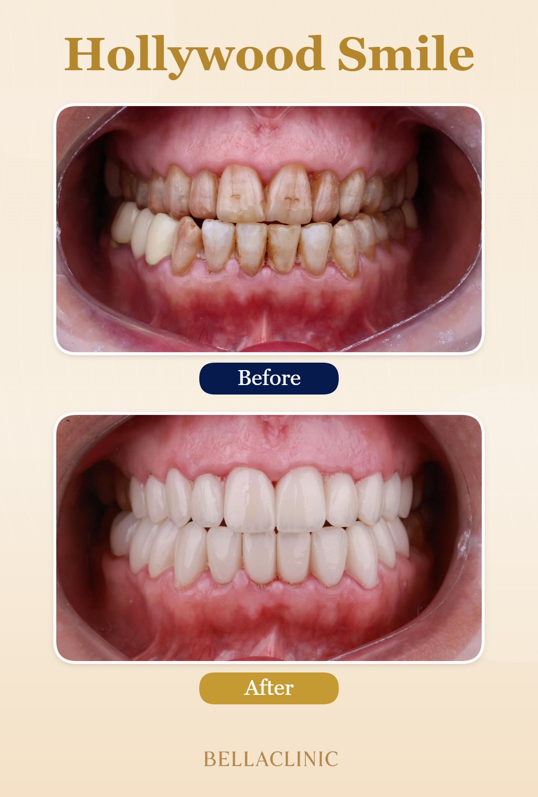 before-after-20260722-113430-Yvh7Ry.jpg