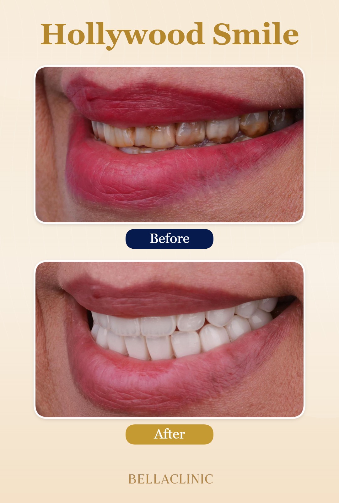 before-after-20260722-113521-OhpxJ5.jpg