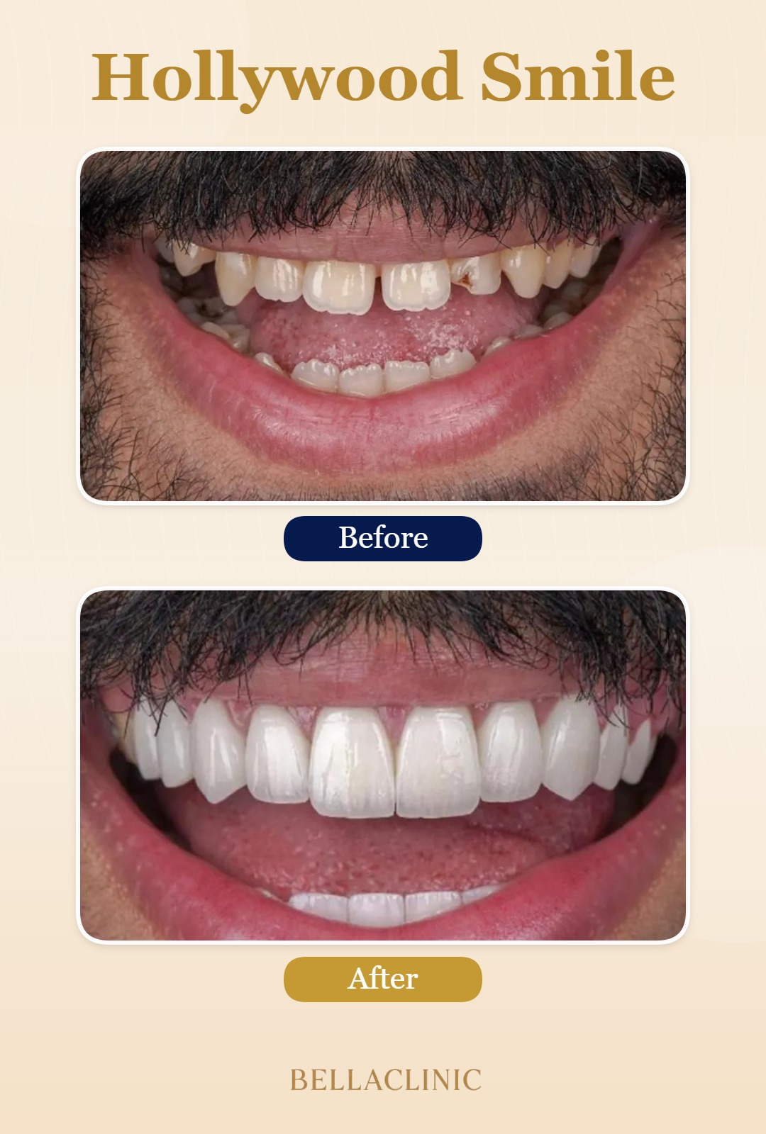 before-after-20260722-113630-wuIJbg.jpg