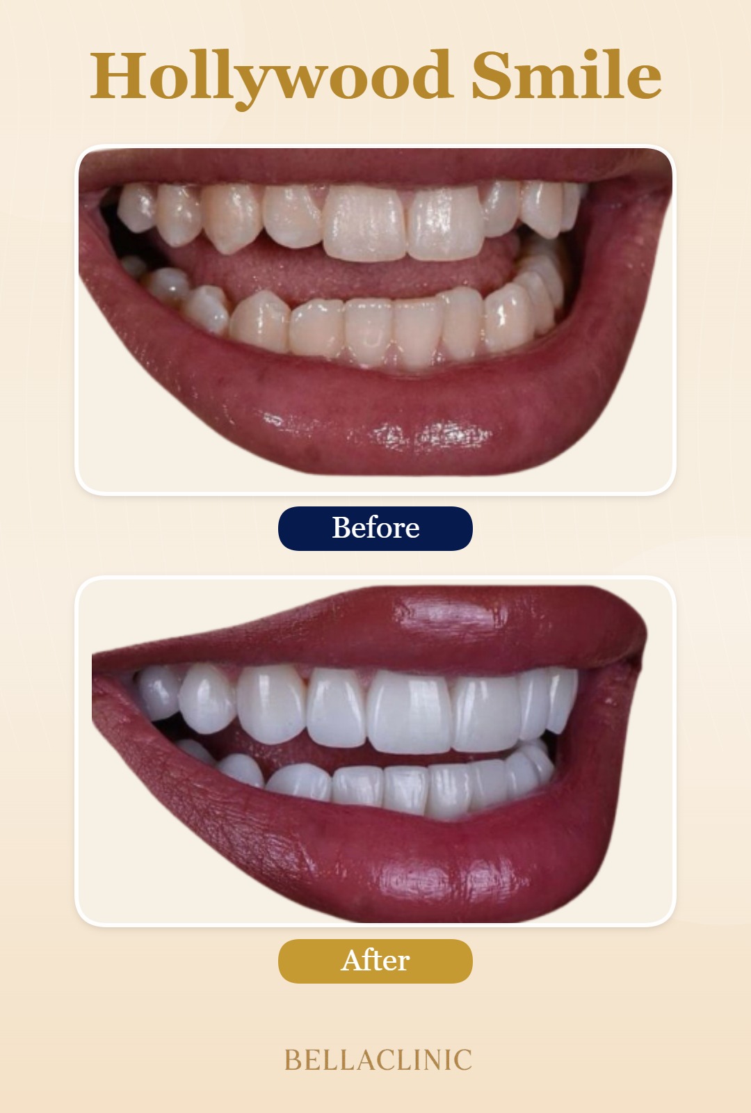 before-after-20260722-113807-PdjP4W.jpg