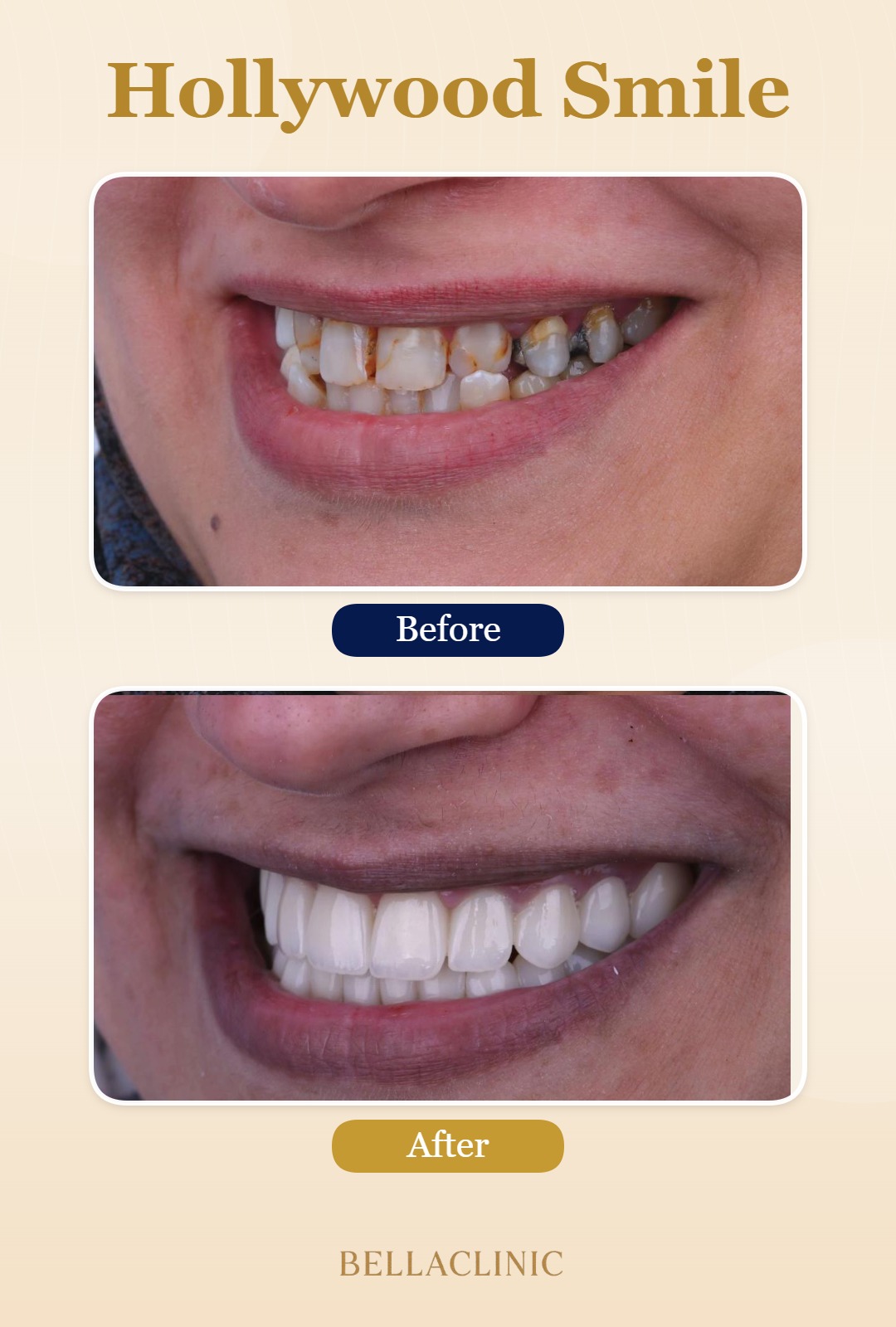 before-after-20260722-114201-1aP9Co.jpg