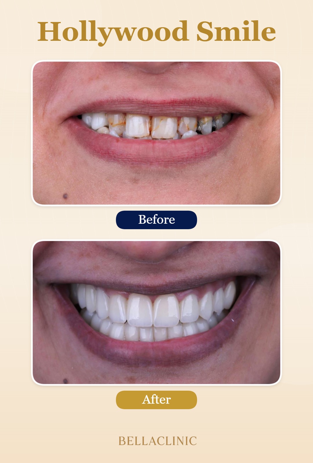 before-after-20260722-114235-Vj4dUk.jpg