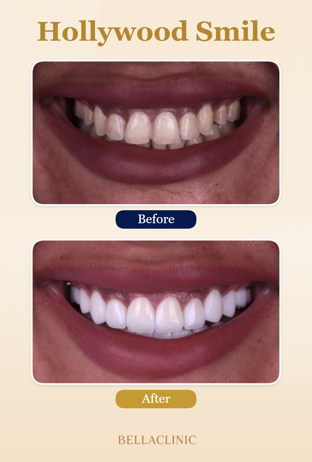 before-after-20260722-114331-lHY1Zw.jpg