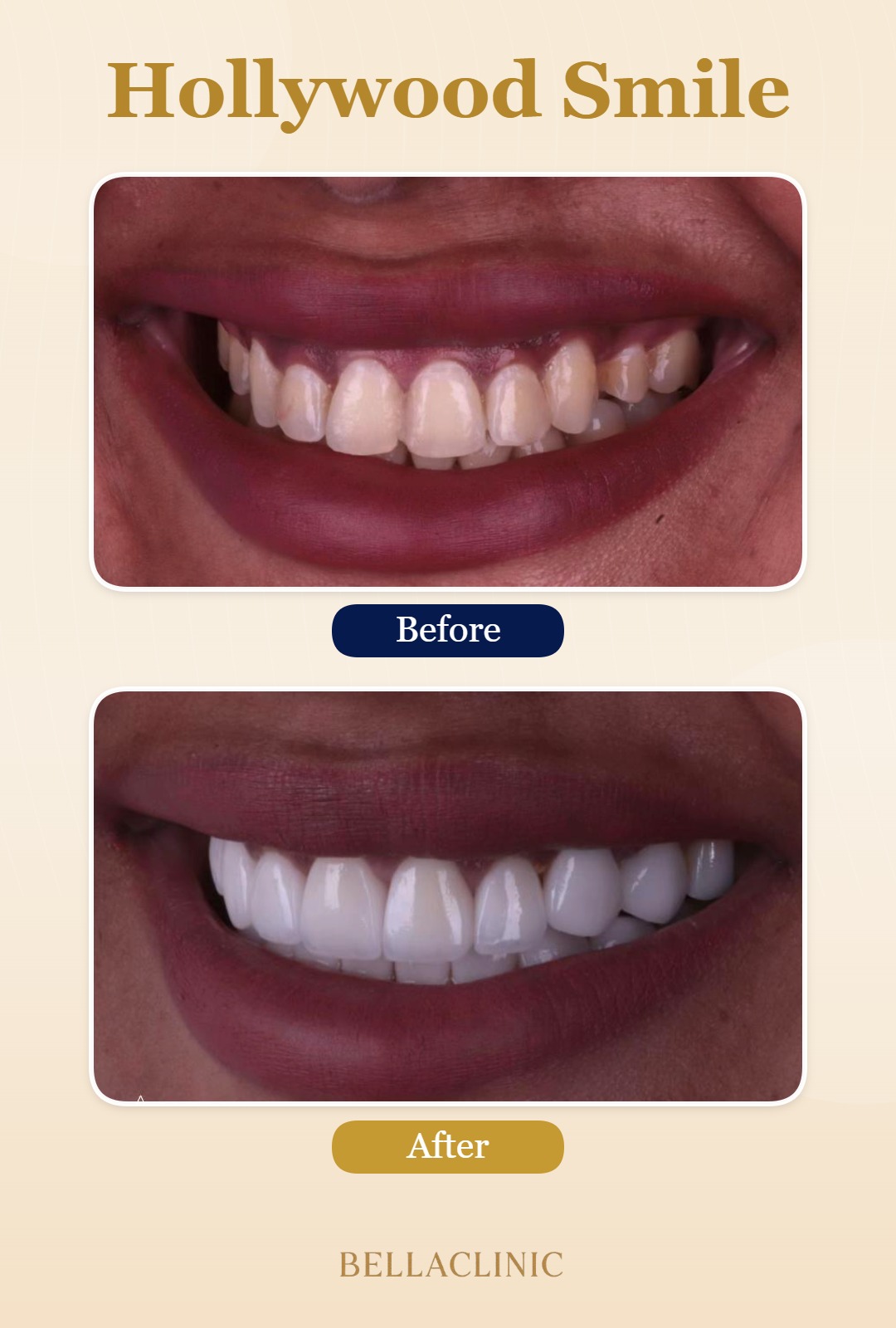 before-after-20260722-114419-Fa6Rv1.jpg