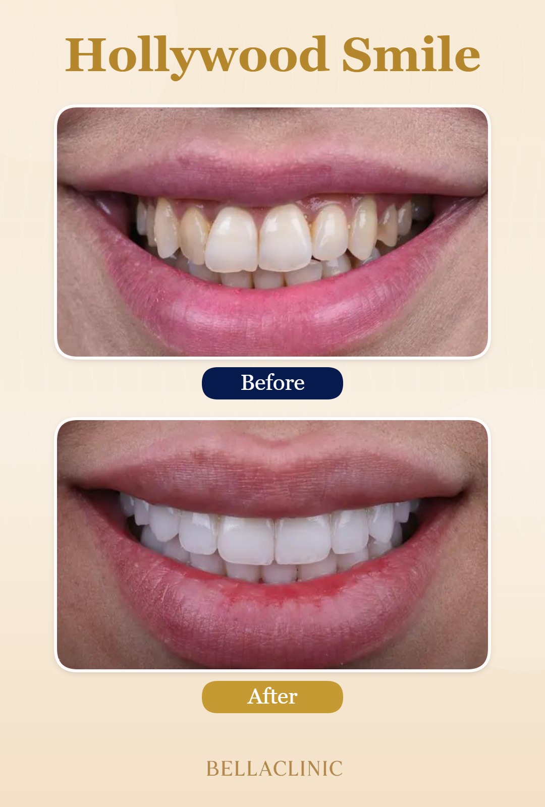 before-after-20260722-114458-d5umsL.jpg