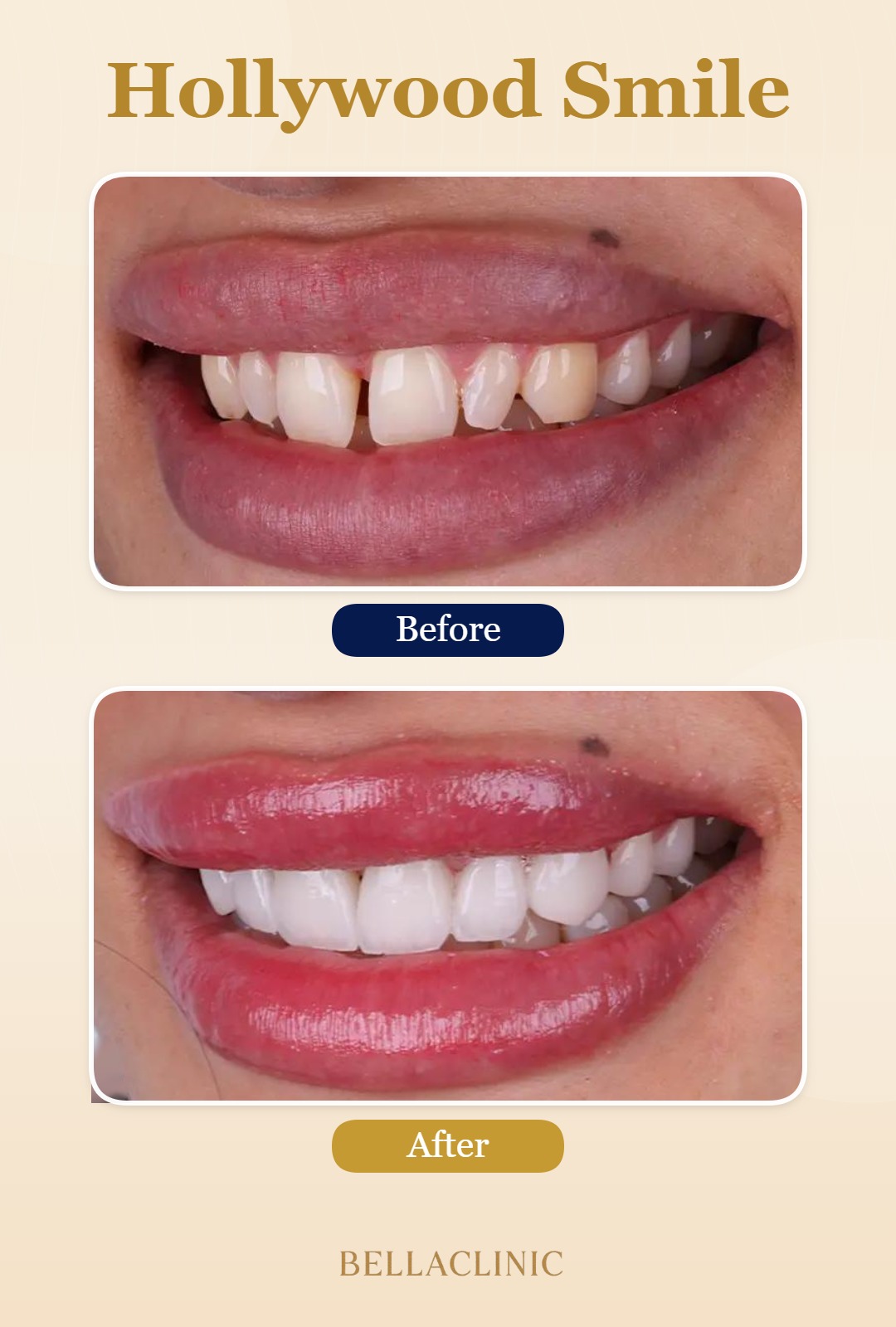 before-after-20260722-114642-NHjLZD.jpg