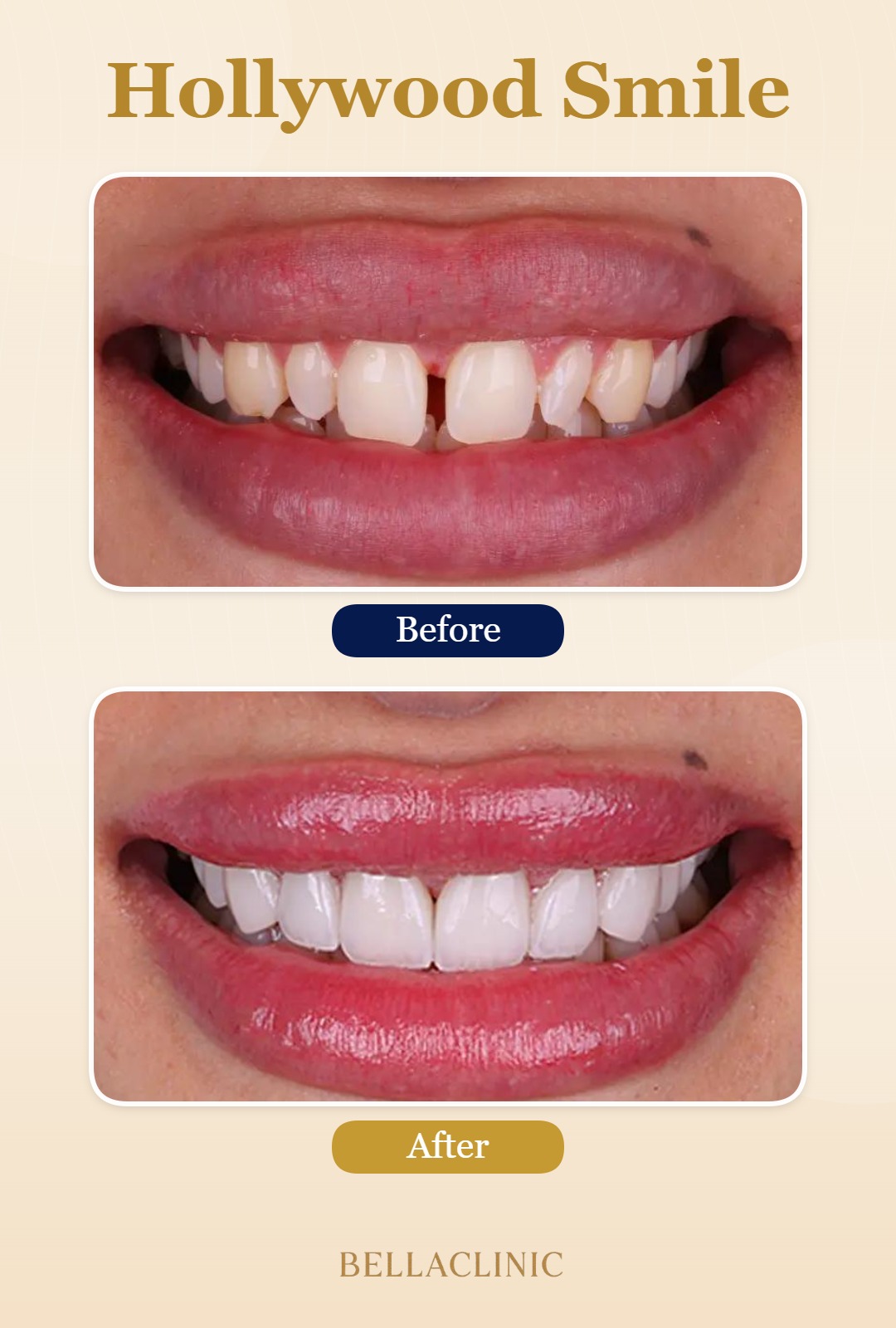 before-after-20260722-114830-qq4wcK.jpg