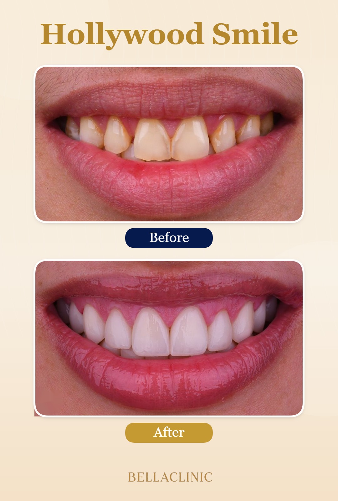before-after-20260722-114918-fyuWtB.jpg