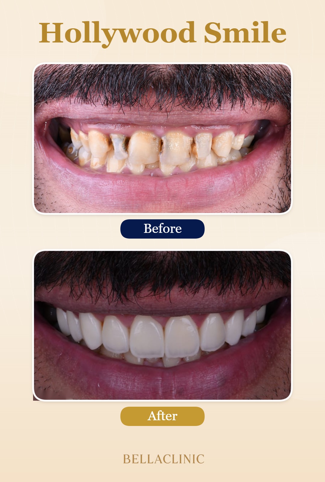 before-after-20260722-115157-QvWn7y.jpg