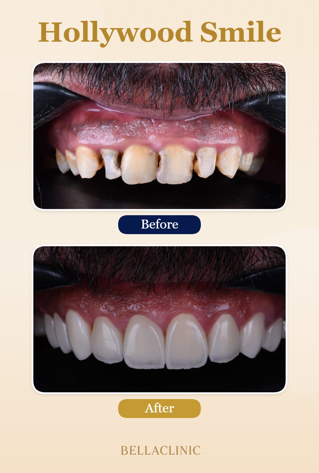 before-after-20260722-115320-j3jIAn.jpg