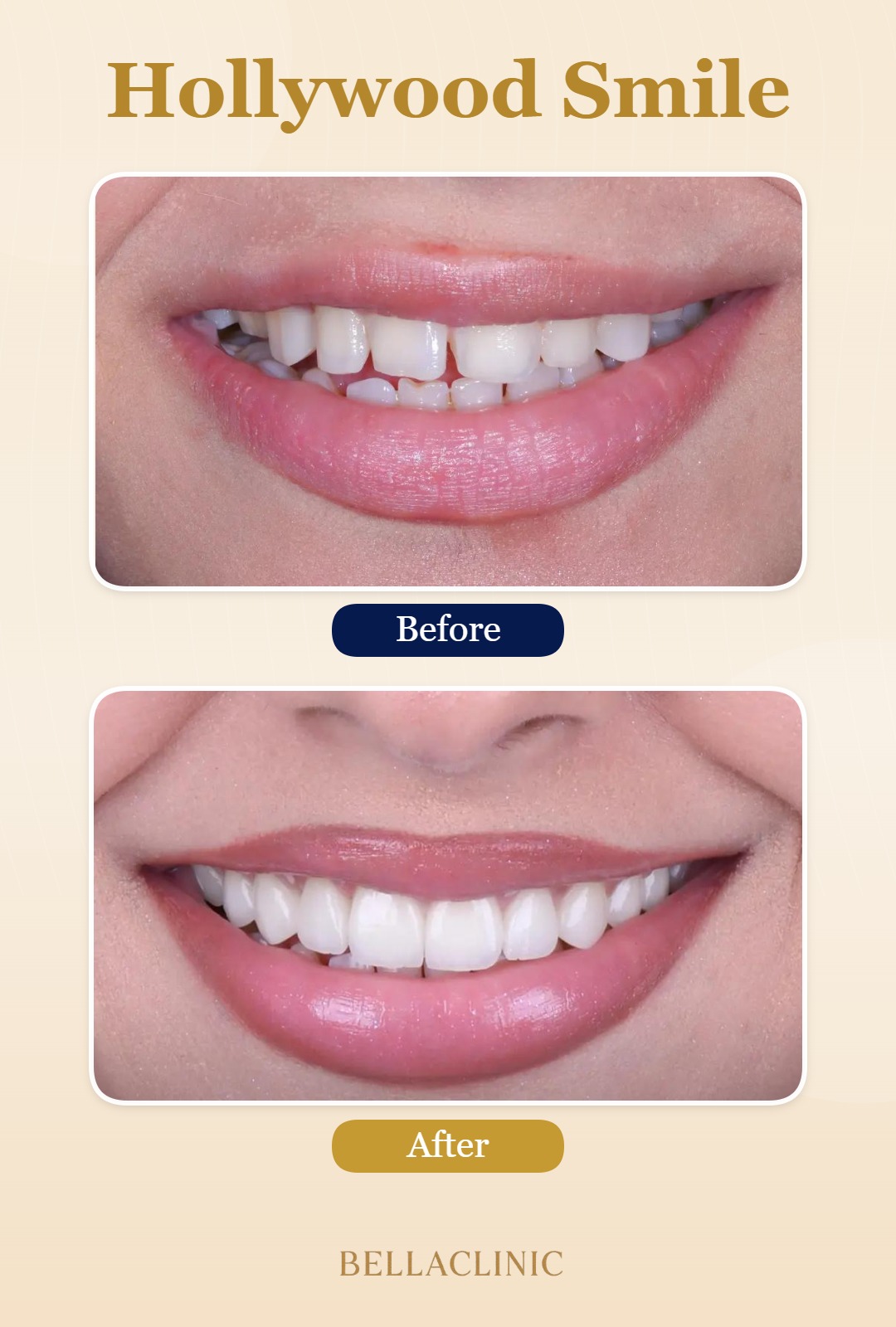 before-after-20260722-115750-5sQVPb.jpg