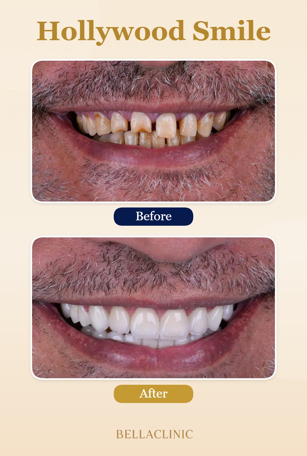 before-after-20260722-115817-XE9zpY.jpg