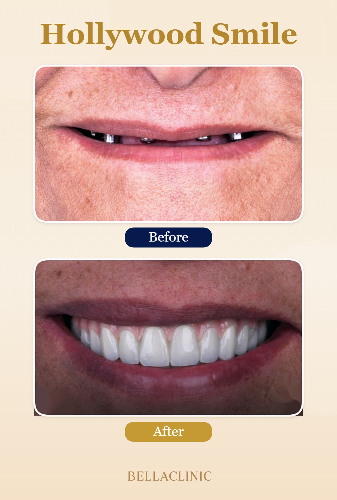 before-after-20260722-115922-ORMnzR.jpg