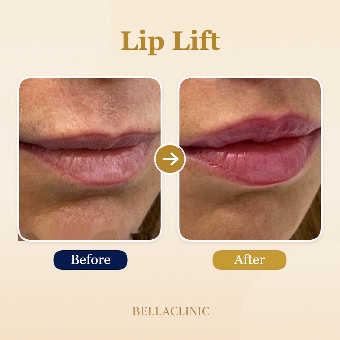 before-after-20260720-175021-Ae6rK9.jpg