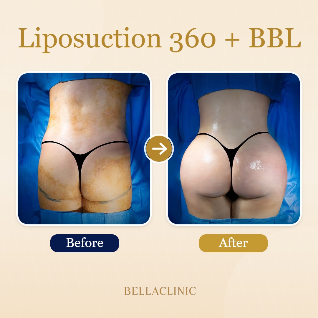 before-after-20260710-151227-44Imz0.jpg