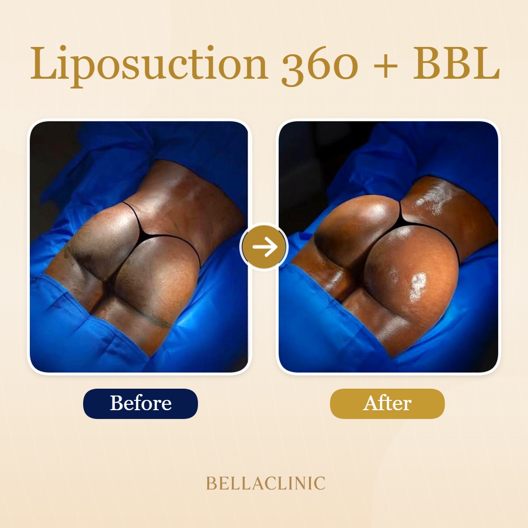 before-after-20260710-151440-Wv4mwb.jpg