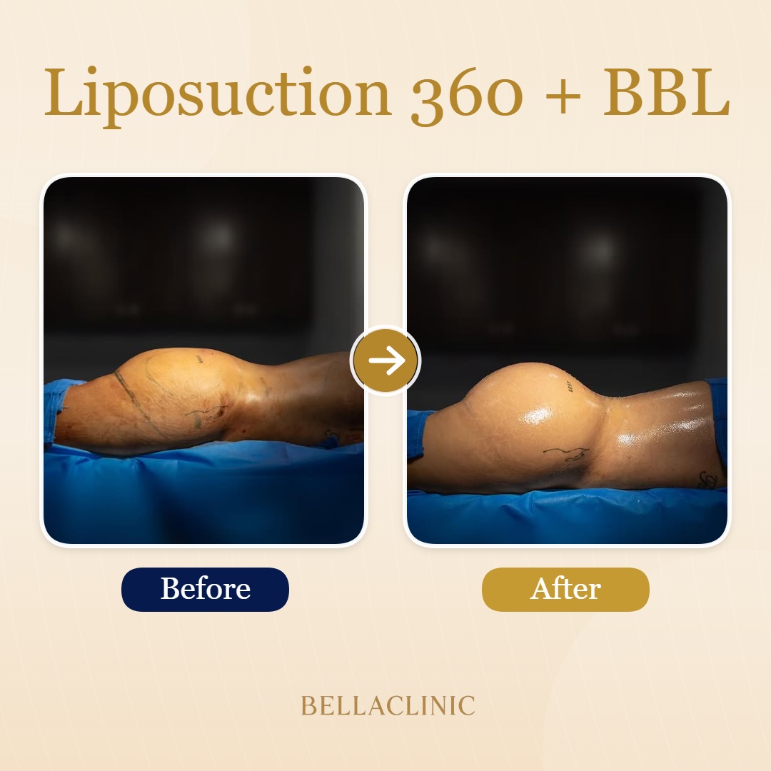 before-after-20260710-151725-WUvktK.jpg