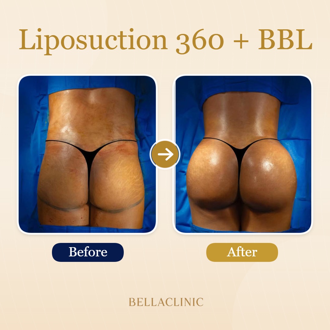 before-after-20260710-152707-y3E6eE.jpg