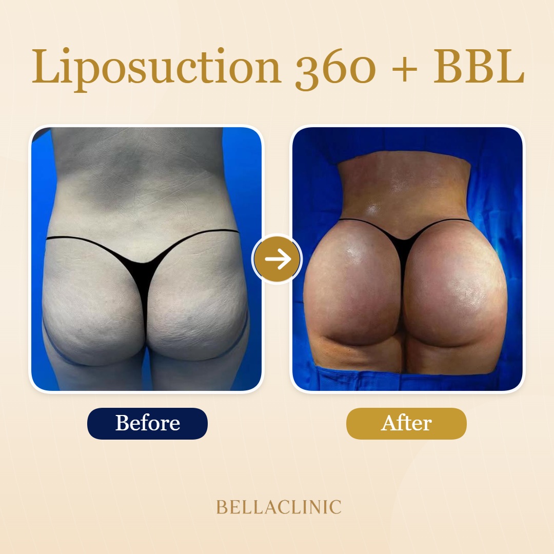 before-after-20260710-153143-xVlsmd.jpg