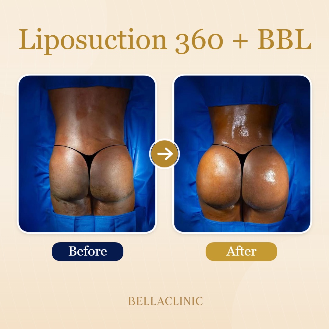 before-after-20260710-153243-ZamjxL.jpg