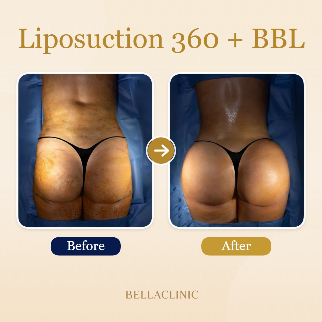 before-after-20260710-154745-GxzgY6.jpg