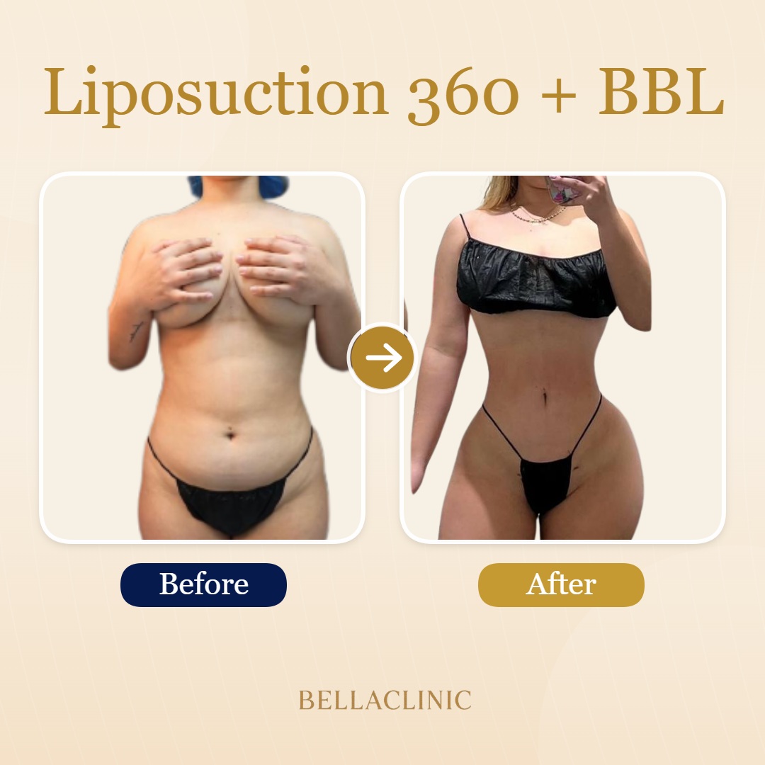 before-after-20260710-210527-ocV0xS.jpg