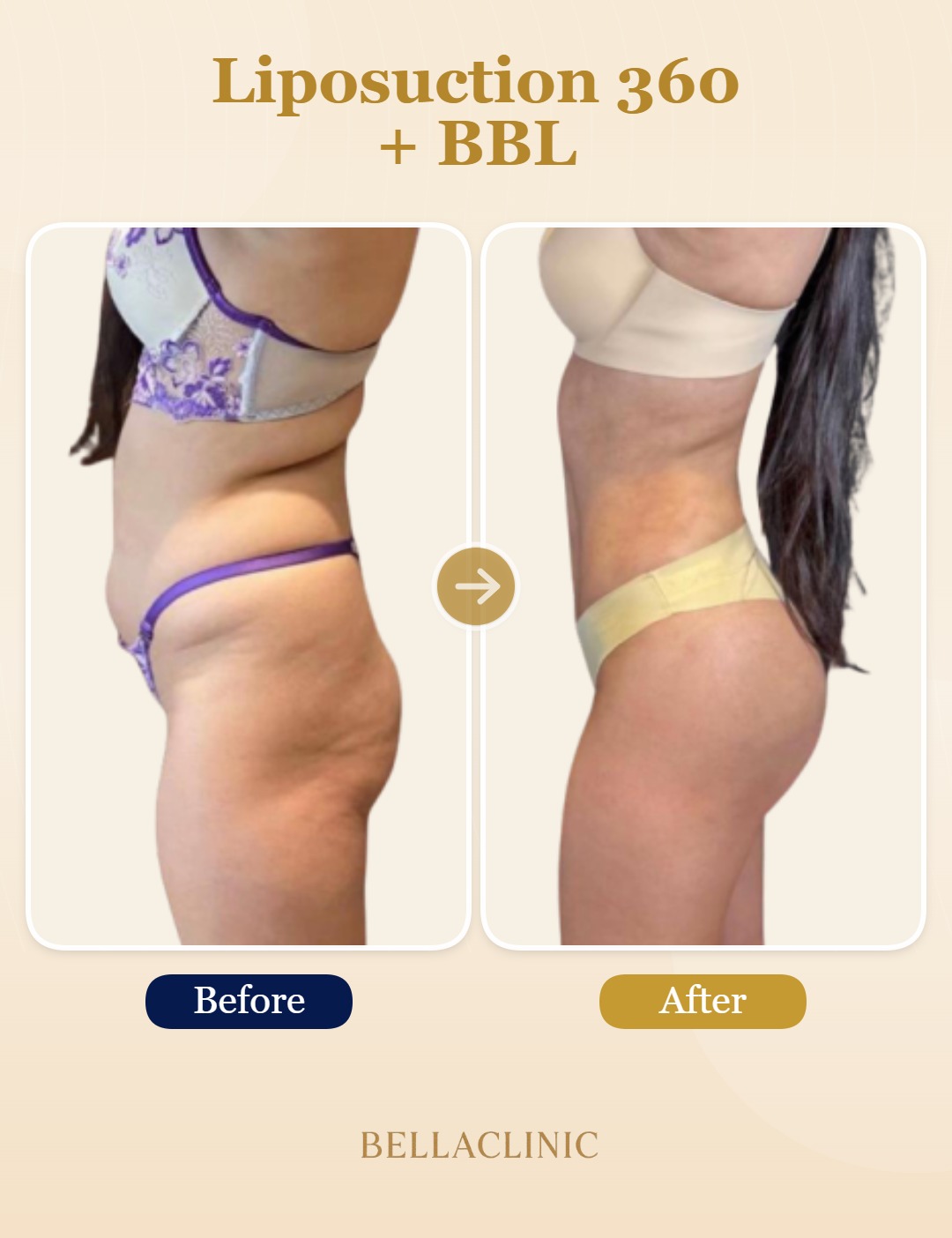 before-after-20260720-164038-Mkz9hX.jpg