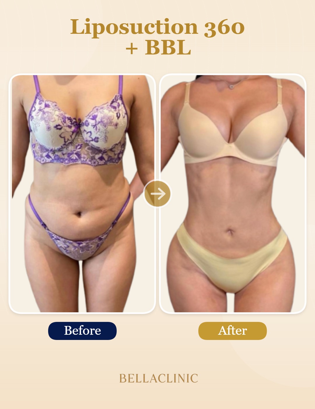 before-after-20260720-164354-GVfGon.jpg