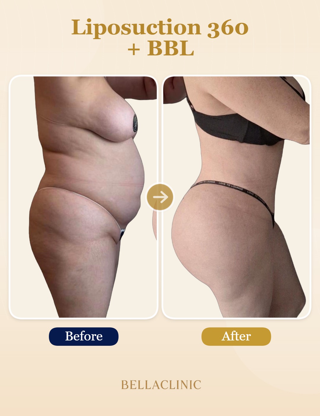 before-after-20260720-164438-MBpKpp.jpg