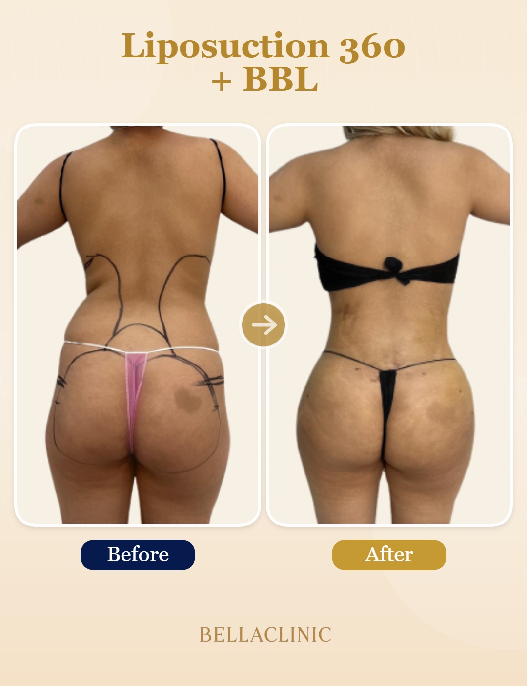 before-after-20260721-234529-NVPEO6.jpg