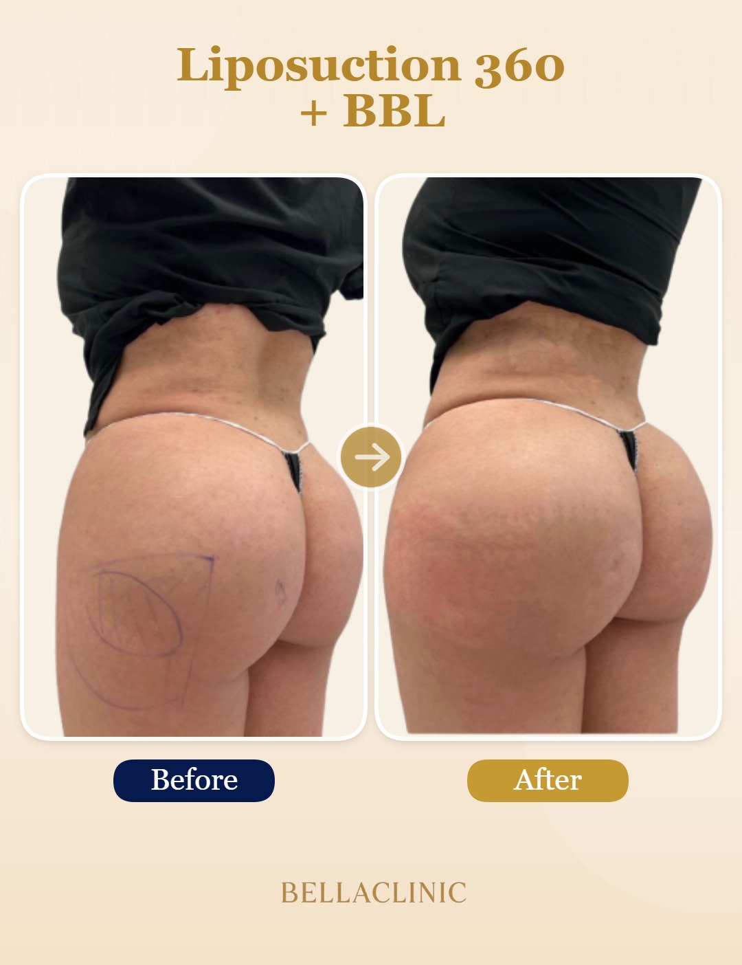 before-after-20260721-234905-iJMZjx.jpg