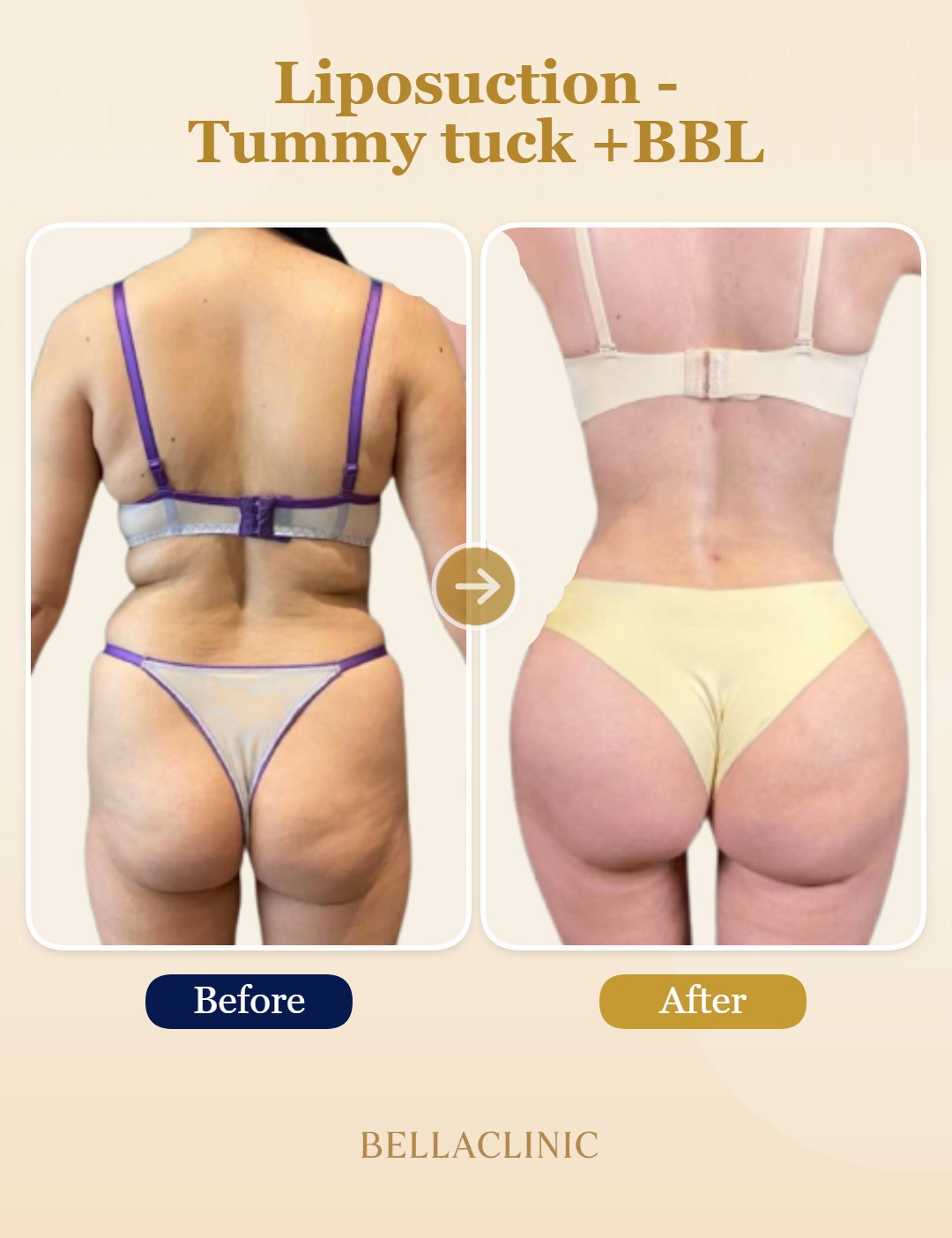 before-after-20260721-163446-w2itRn.jpg