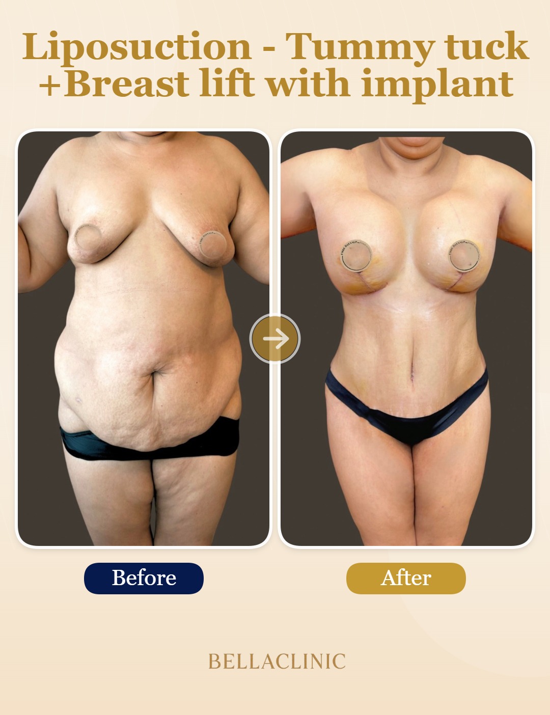 before-after-20260717-171007-yRWoWO.jpg