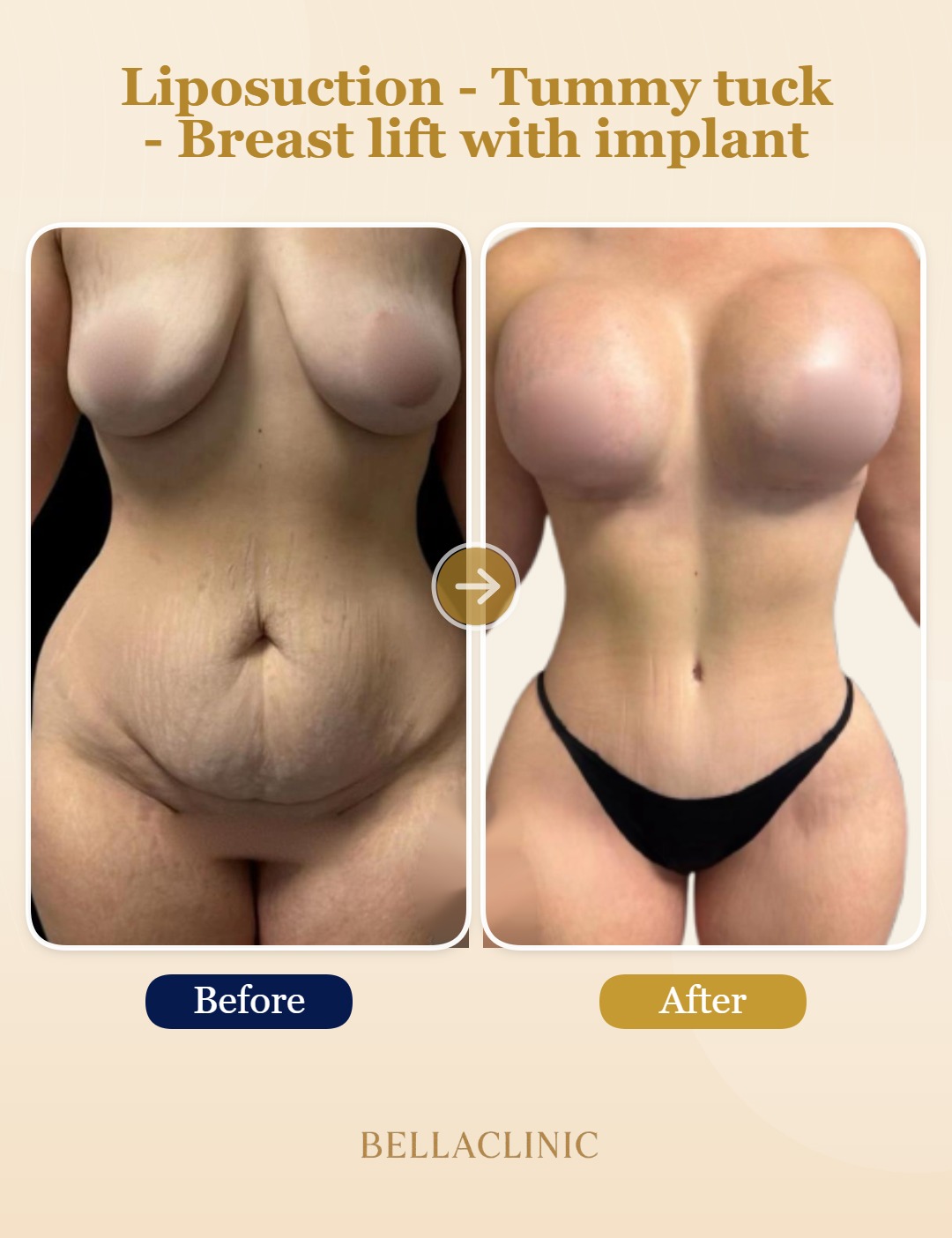 before-after-20260721-162936-OdCIfk.jpg