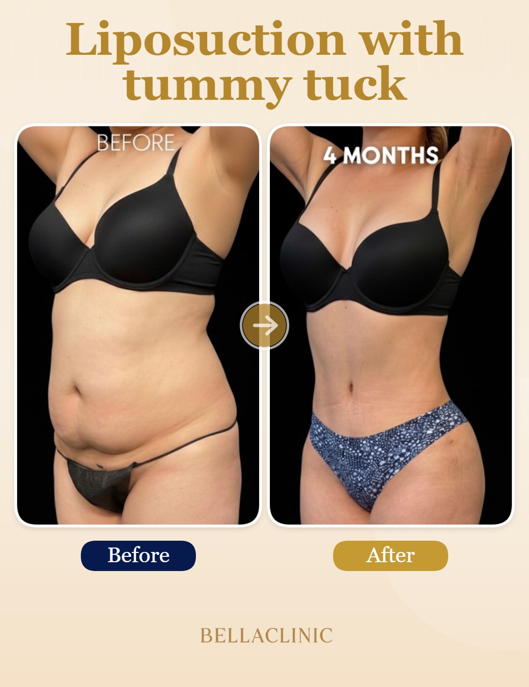 before-after-20260717-171300-DCDthM.jpg