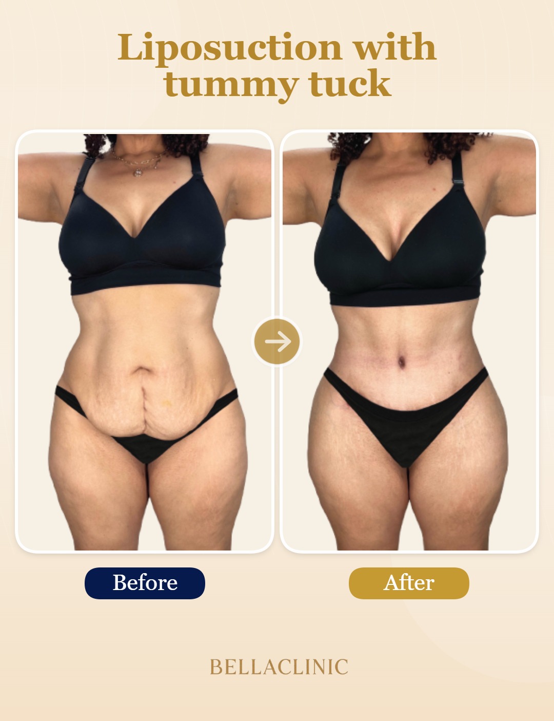 before-after-20260720-164646-sLIrRt.jpg