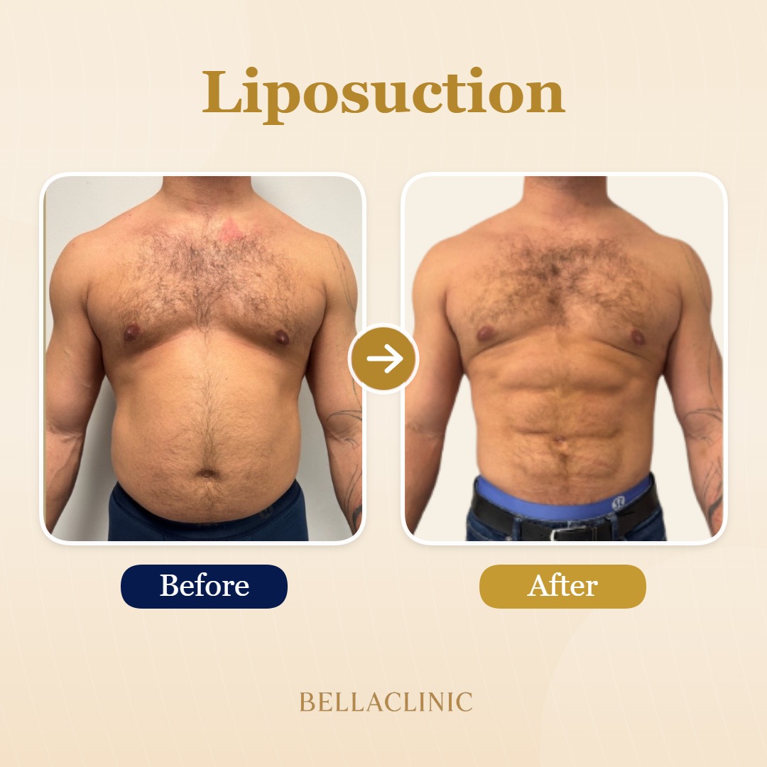 before-after-20260721-154724-hZlJcj.jpg